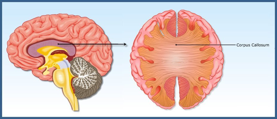Corpus collosum