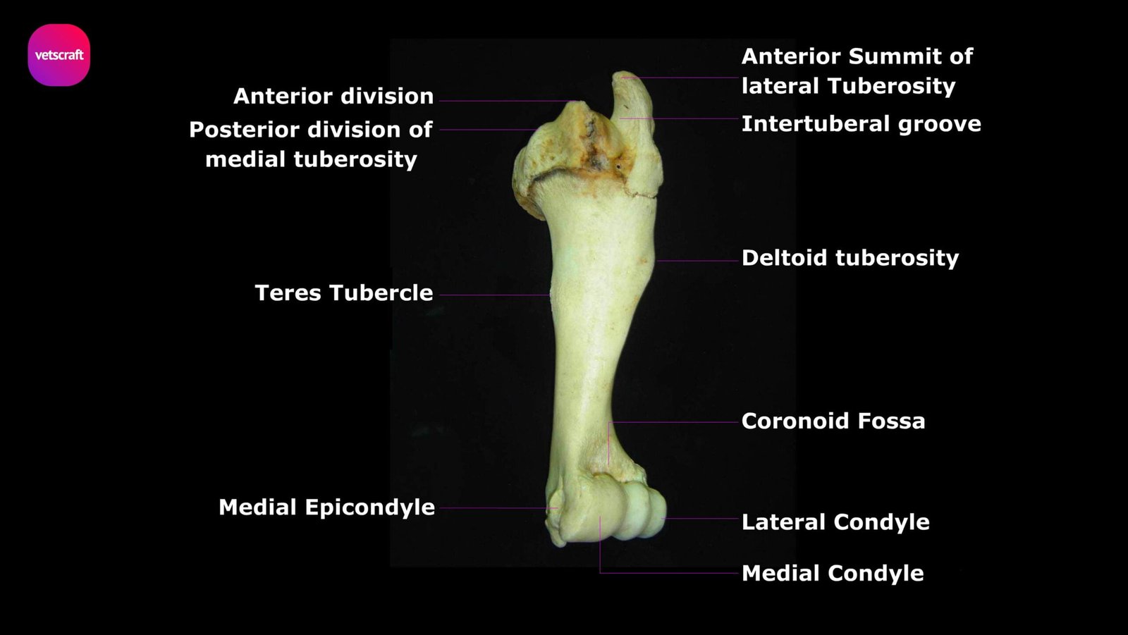humerus anterior view