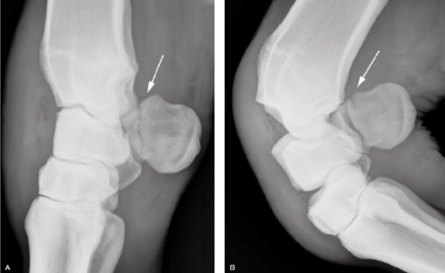 Lateromedial (A) and flexed lateromedial (B) radiographs of a fracture of the accessory carpal bone (arrows)- Fracture of carpal bone