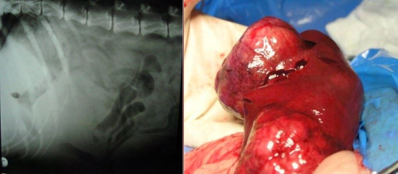 Neoplasia or tumor of liver- Surgical affection of liver