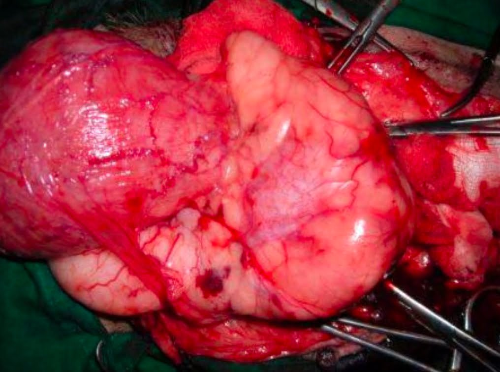 Prostatic abscess in a dog