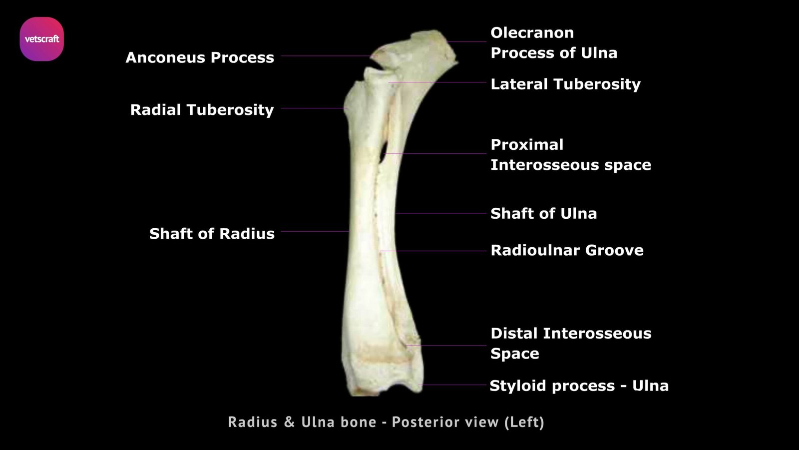 human radius and ulna