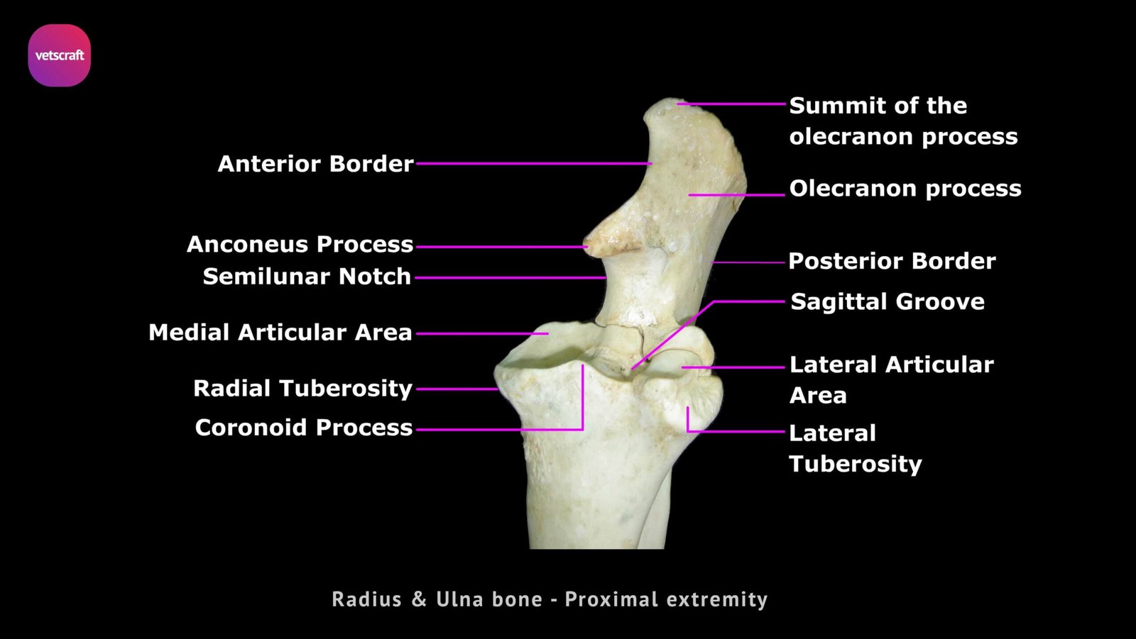 real radius bone