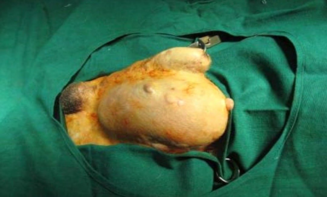 Testicular tumor in a dog- Surgical affections of testicle and Scrotum