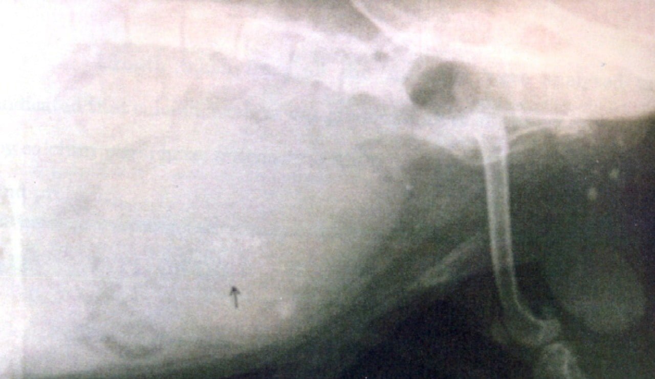 X-ray radiograph shows the presence of urethral and cystic calculi with distended bladder- Affections of Kidney and urinary system