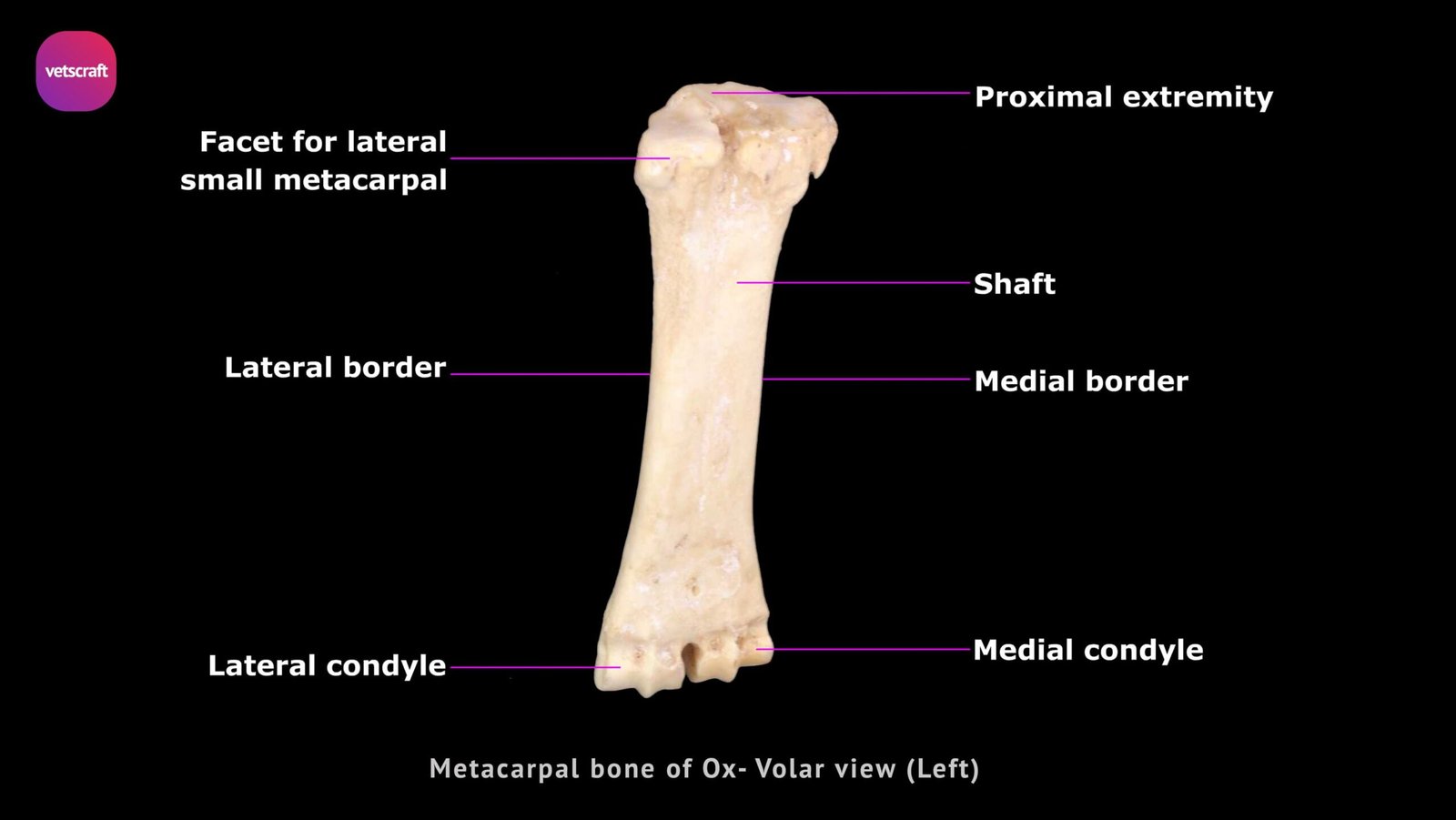 metacarpals anatomy