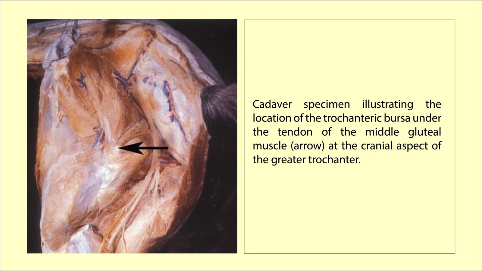 Cadaver specimen illustrating the location of the trochanteric bursa under the tendon of the middle gluteal muscle (arrow) at the cranial aspect of the greater trochanter in Trochanteric Bursitis in Horses