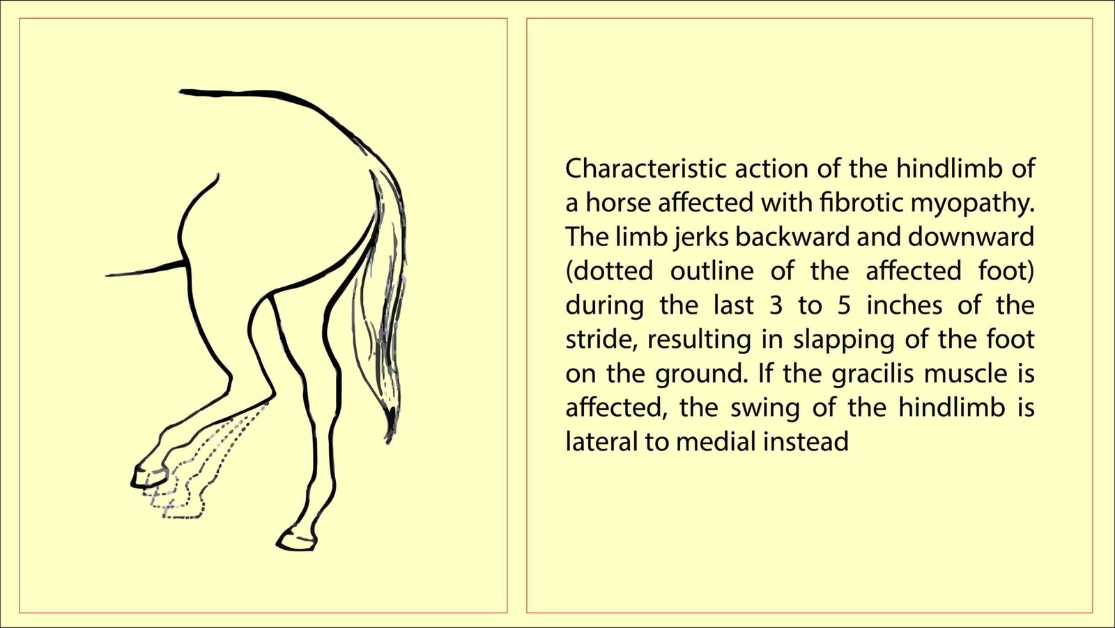 Characteristic action of the hindlimb of a horse affected with fibrotic myopathy (FIBROTIC MYOPATHY AND OSSIFYING MYOPATHY)