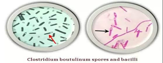 Clostridium botulinum spore and bacilli (Botulism disease causing bacteria in animals)