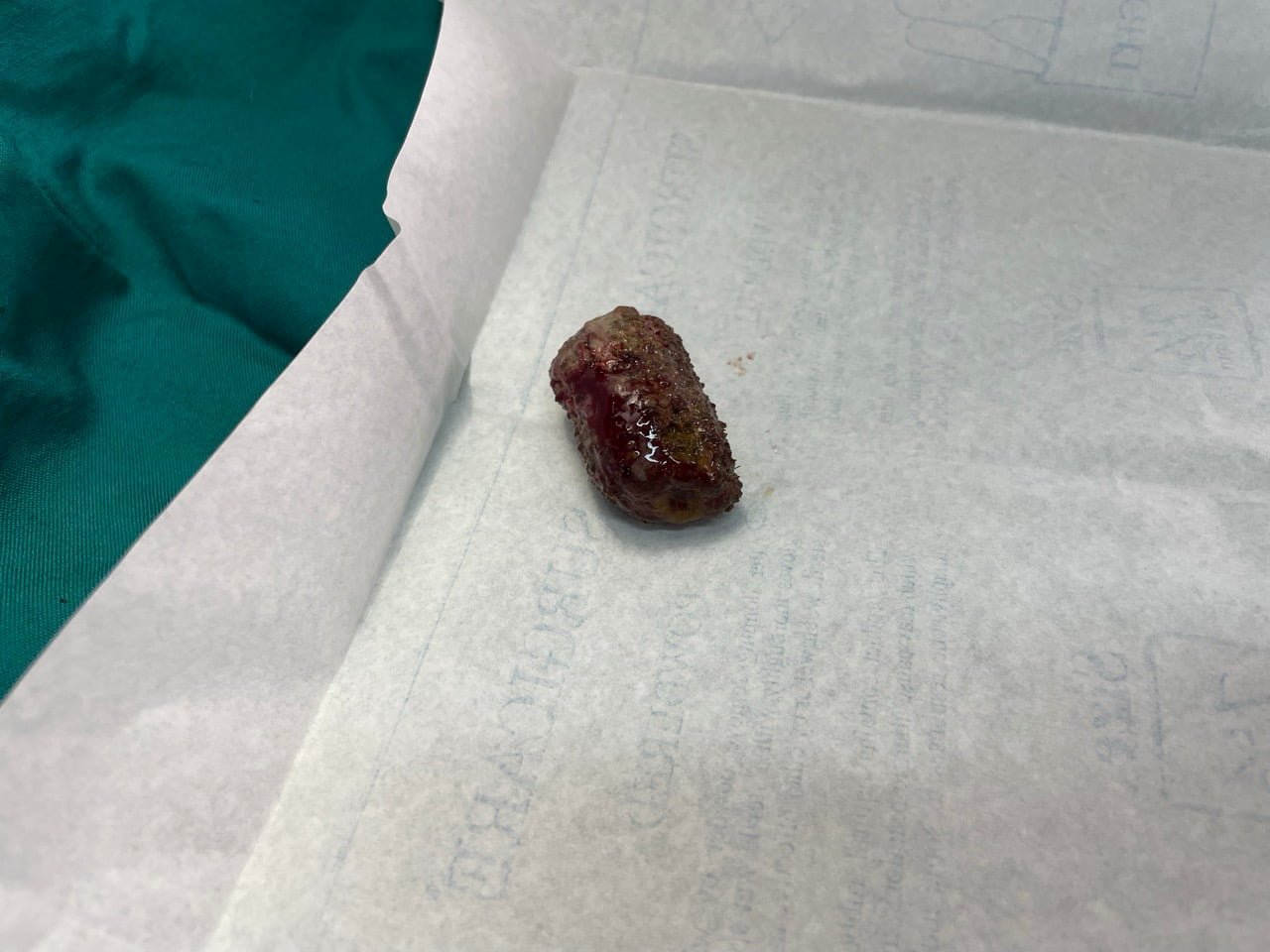 Intestinal Obstruction of corn (maize) in intestine of a dog