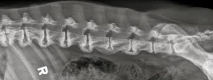 Radiograph showing Spondylosis in a vertebral column