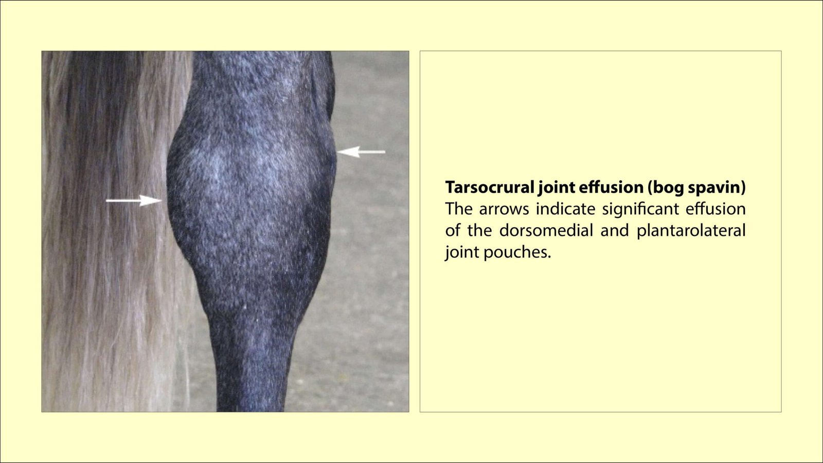 Tarsocrural joint effusion (bog spavin)- The arrows indicate significant effusion of the dorsomedial and plantarolateral joint pouches